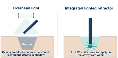 Overhead-light_integrated-light-1