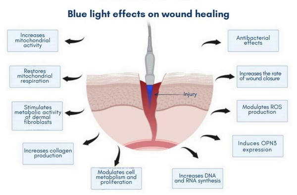 blue-light-effects