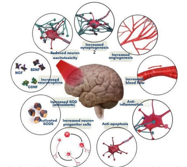 brain-photobiomodulation-therapy-3