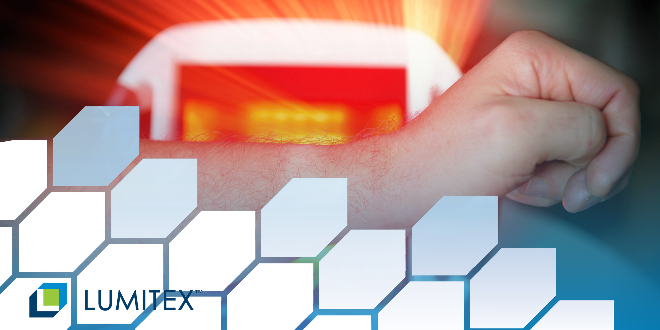 その他 pbm HEALING PBM treatment improves burn wound healing. (a) Representative