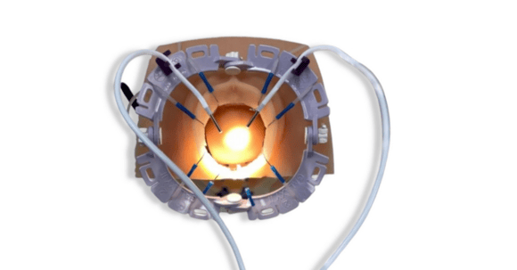 in-cavity lighting